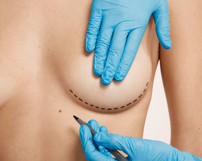 Surgeon consulting a patient about Motiva Breast Augmentation